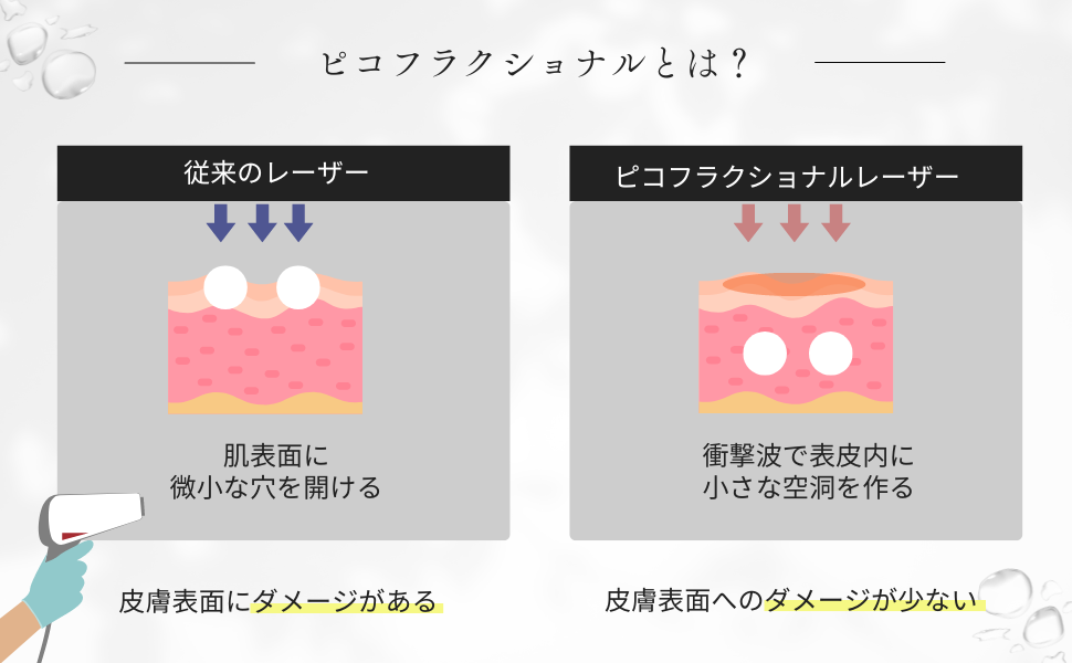 Explanation Image of Pico Fractional - Ginza My Beauty Clinic